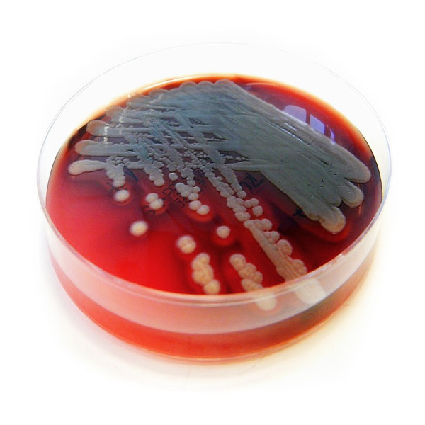 SFB900_A02_Abbildung-01